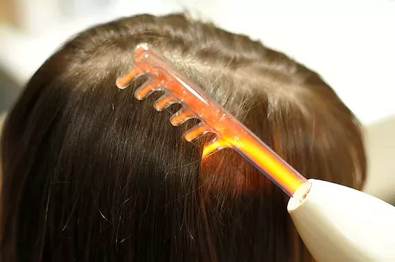 Terapia Capilar para Problemas de Couro Cabeludo